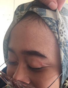 Mahasiswi di salah satu Kampus Di  Kabupaten Langkat berinisial R-A (17) lapor ke polisi terkait kasus pemukulan yang terjadi kepadanya