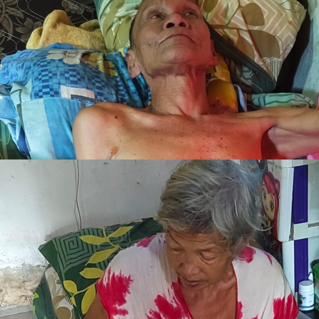 Mariana dan Rusmika Djayusman Lumpuh Akibat Gejala Stroke